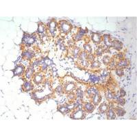 β-actin Polyclonal Antibody