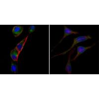 AATM Monoclonal Antibody