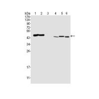 AATM Monoclonal Antibody