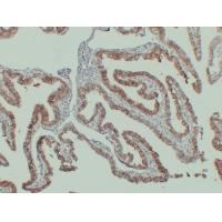 N-cadherin Monoclonal Antibody PT0199