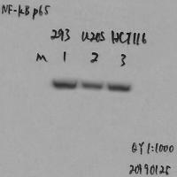 NFkB p65 Monoclonal Antibody14H2