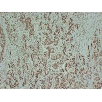 Estrogen receptor ER-ALPHA Monoclonal Antibody PT0904