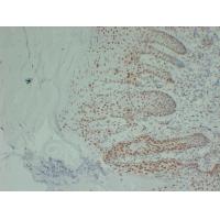 Estrogen receptor ER-ALPHA Monoclonal Antibody PT0904