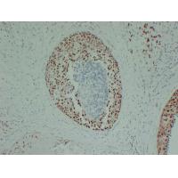 Estrogen receptor ER-ALPHA Monoclonal Antibody PT0904