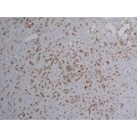 FLI1 8A1 mouse Monoclonal Antibody