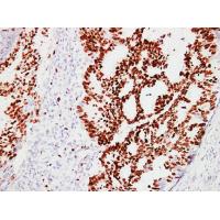 Ki-67 Monoclonal Antibody PT0159