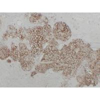 KSP-Cadherin Monoclonal Antibody PT0161