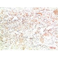 Collagen II Mouse Monoclonal Antibody8F6