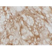 Collagen Type II Monoclonal Antibody PT0115