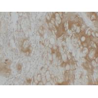 Collagen Type II Monoclonal Antibody PT0115