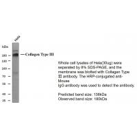 Collagen Type III Monoclonal Antibody PT0117