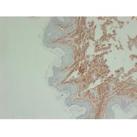 Collagen Type III Monoclonal Antibody PT0117