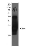 Cystatin C Mouse Monoclonal Antibody5F1