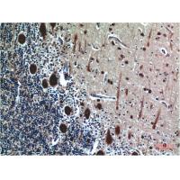 Cystatin C Mouse Monoclonal Antibody5F1