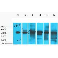 Cytokeratin 18 Monoclonal Antibody1B3