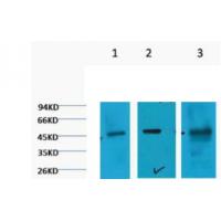 Cytokeratin 18 Monoclonal Antibody2F7