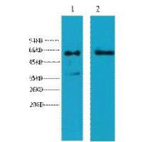 Cytokeratin 6 Monoclonal Antibody4A1