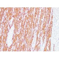 Desmin Monoclonal Antibody PT0121