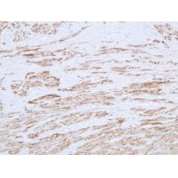 Desmin Monoclonal Antibody PT0121