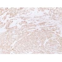 Desmin Monoclonal Antibody PT0121