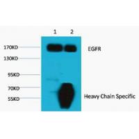 EGFR Monoclonal AntibodyM6