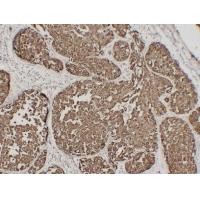 EMA CA 15.3, MUC1 7G1 mouse Monoclonal Antibody