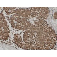 EMA CA 15.3, MUC1 7G1 mouse Monoclonal Antibody