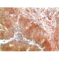 ATG5 Mouse Monoclonal Antibody8B4