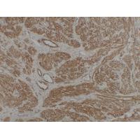 Caldesmon 1C1 mouse Monoclonal Antibody