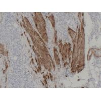 Calponin-1 1D1 mouse Monoclonal Antibody