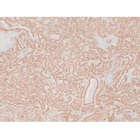 Calretinin Monoclonal Antibody PT0014