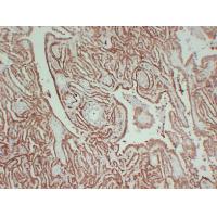 Calretinin Monoclonal Antibody PT0014