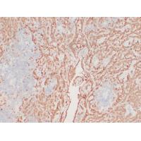 Calretinin Monoclonal Antibody PT0014