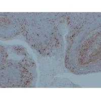 CD14 Mouse Monoclonal AntibodyPT0019