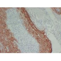 CK-16 5B1 mouse Monoclonal Antibody