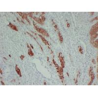 CK-16 5B1 mouse Monoclonal Antibody