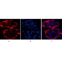 CK-17 Monoclonal Antibody10A1