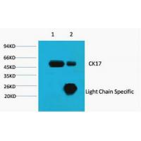 CK-17 Monoclonal Antibody10A1