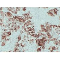 CK-6 Monoclonal Antibody PT0091