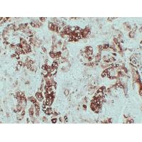 CK-6 Monoclonal Antibody PT0091