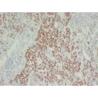 Growth HormoneGH Monoclonal Antibody PT0148