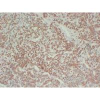 Growth HormoneGH Monoclonal Antibody PT0148