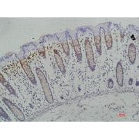 Galectin-3 Monoclonal Antibody1H4