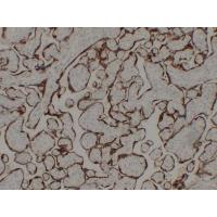 hCG 8G1 mouse Monoclonal Antibody