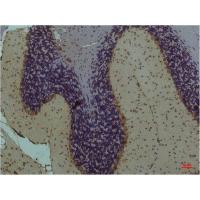 STAT3 Monoclonal Antibody1E3