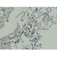 TRAP Monoclonal Antibody PT0248