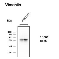 Vimentin Monoclonal Antibody1A7