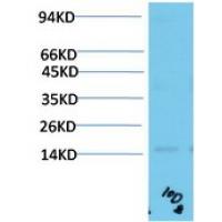 TTR Mouse Monoclonal Antibody10D8