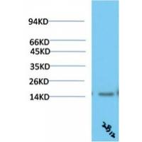 TTR Mouse Monoclonal Antibody2B12