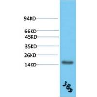 TTR Mouse Monoclonal Antibody3B5